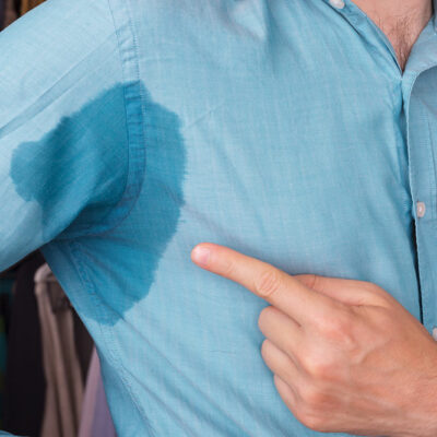 6 Common Triggers of Hyperhidrosis