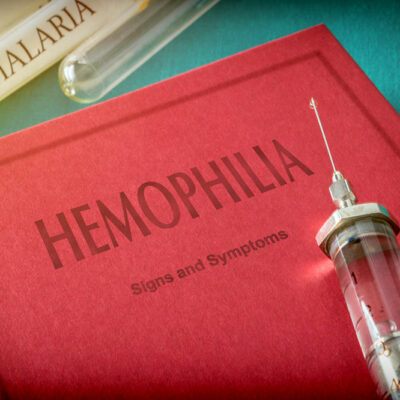 Major Symptoms and Known Treatments for Hemophilia