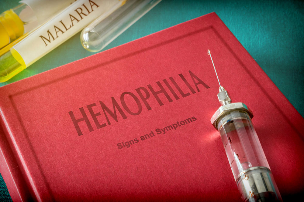 Major Symptoms and Known Treatments for Hemophilia