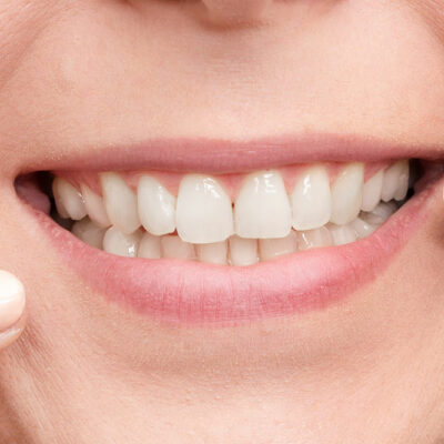 Natural Ways to Whiten Teeth at Home