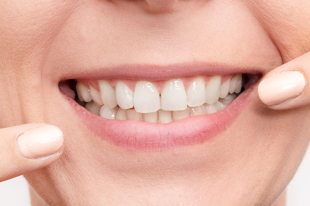 Natural Ways to Whiten Teeth at Home