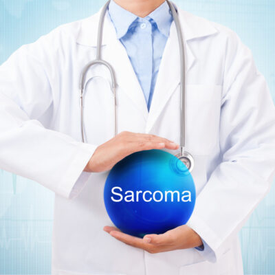 Early Warning Signs Linked to Sarcoma