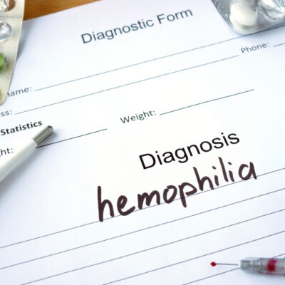 5 Common Symptoms of Hemophilia